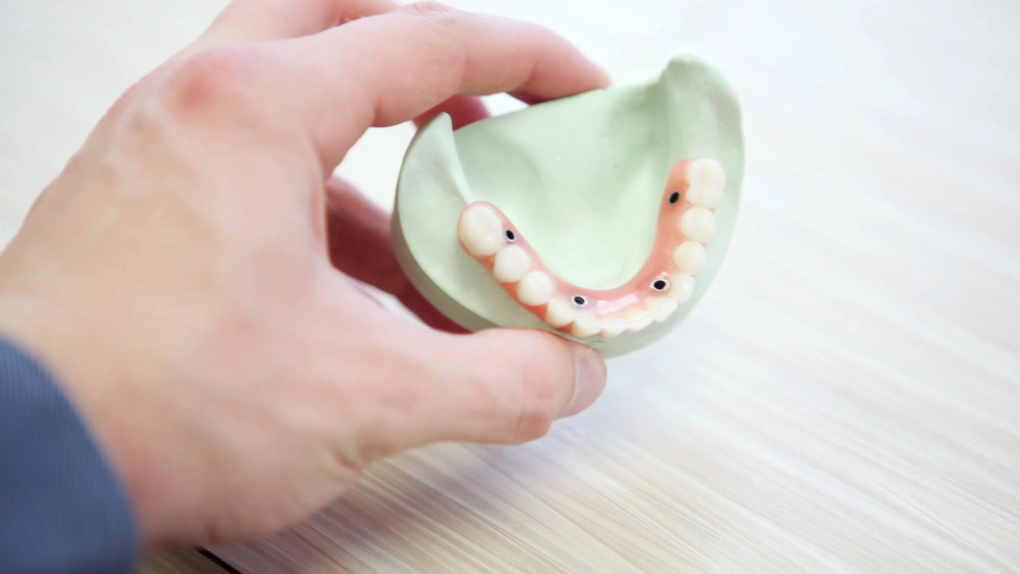 What are dental bridges?